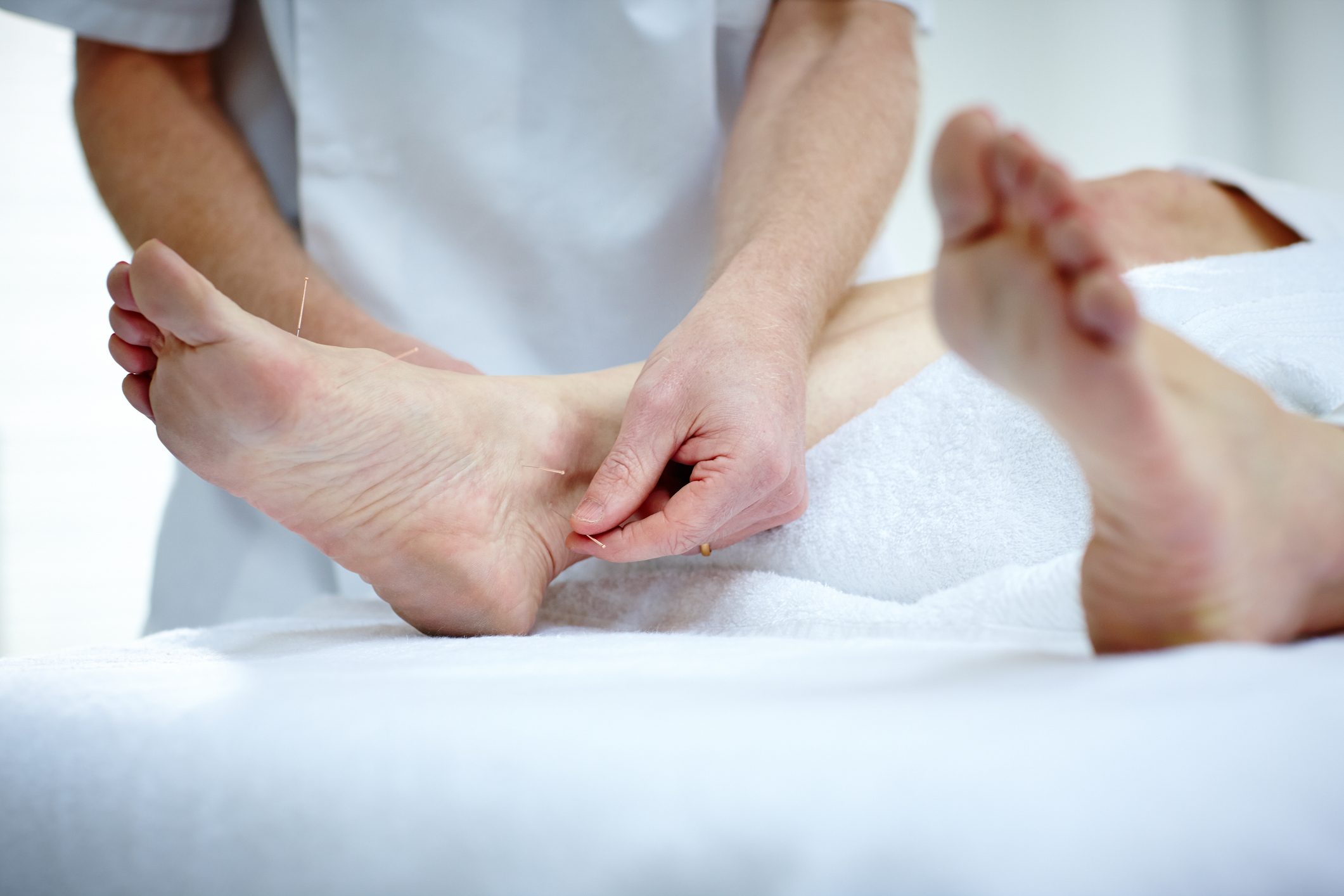 plantar fasciitis acupuncture